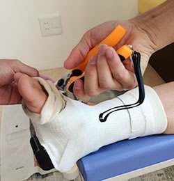 捻挫や骨折の治療法